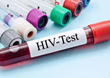 Over 50,000 living with HIV/AIDs in Kogi - Official