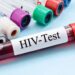 Over 50,000 living with HIV/AIDs in Kogi - Official