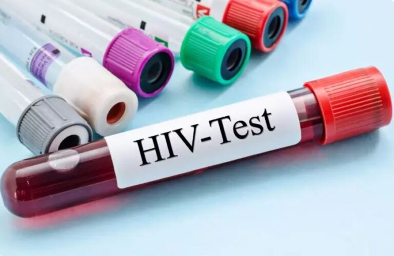 Over 50,000 living with HIV/AIDs in Kogi - Official